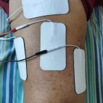 Fisioterapia Pós-operatório de Joelho