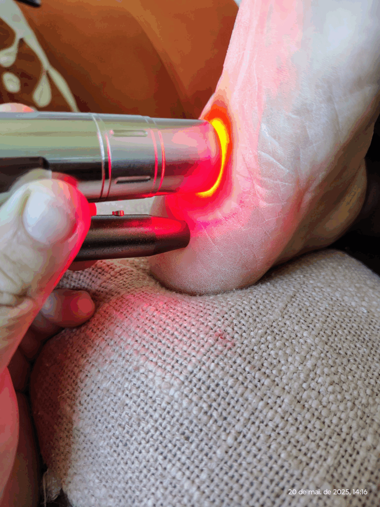 fisioterapia-fascite-plantar-laser-led-salvador.jpg