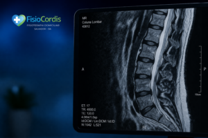 Fisioterapia coluna lombar em Salvador | Tratamento em casa